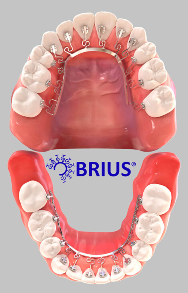 Brava Braces