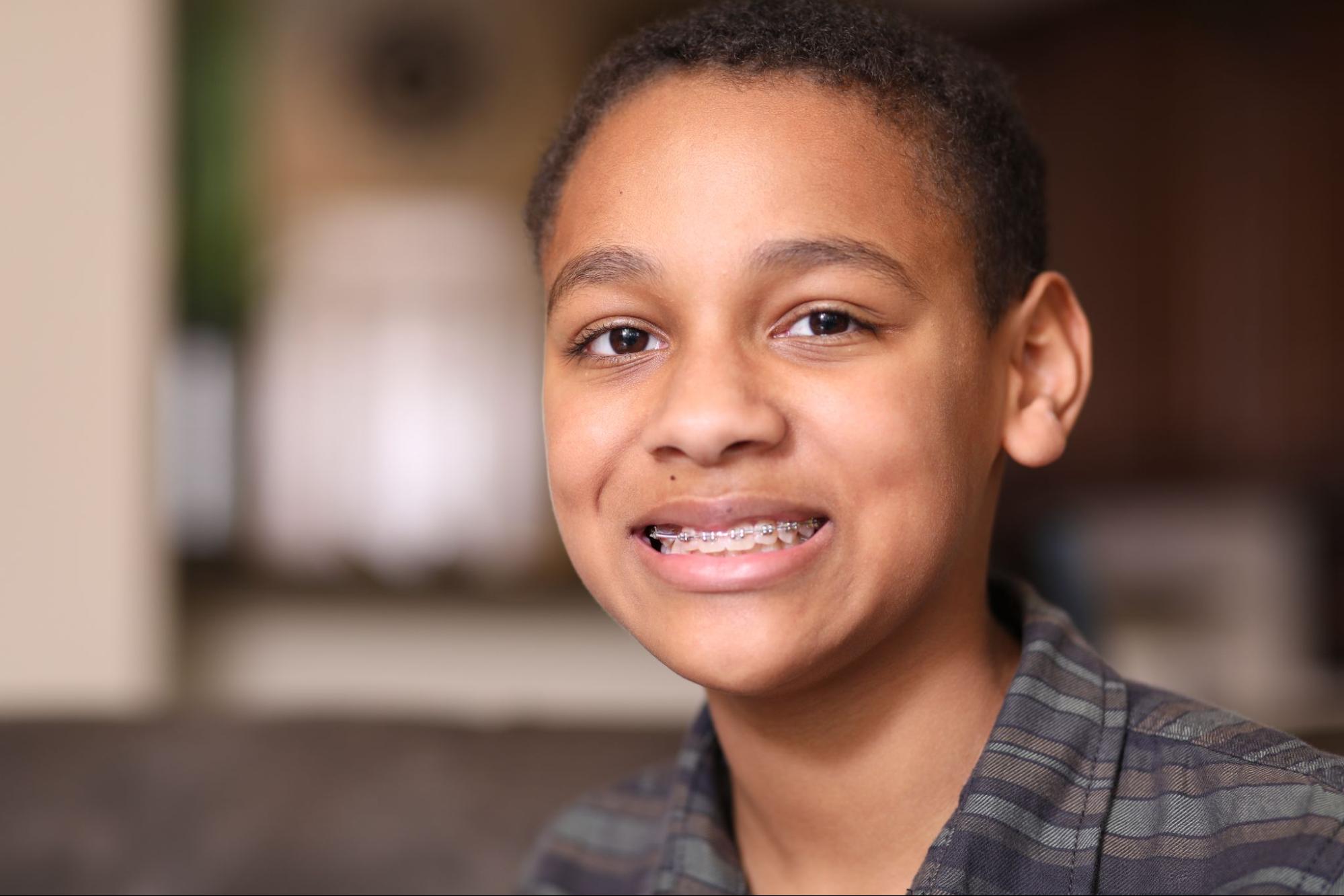 Tips for Keeping Your Braces Clean